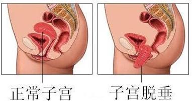 1550970198968470.jpg 201511101922599063.jpg