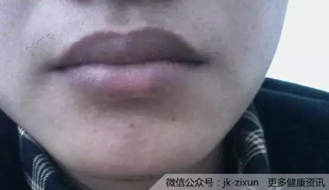 1553827714937620.jpg f5e7008cc7f34c62894d453c8864a93c_th.jpg